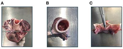 Aortic Valve Leaflet Shape Synthesis With Geometric Prior From Surrounding Tissue